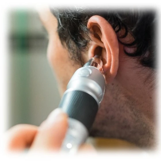 Coupe Poils (nez Et Des Oreilles) 2 Coupe Poils (nez Et Des Oreilles) – Image 2